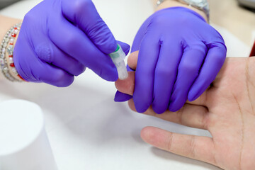 A person's finger is pricked by a doctor to collect a drop of blood for a medical test.