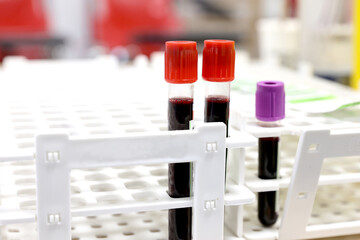 Test tubes filled with blood collected from a person for laboratory analysis