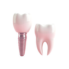 Realistic Human Tooth and Dental Implant with Ceramic Crown and Metal Base, Isolated on transparent background,png