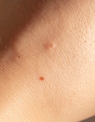 Fototapeta premium Ultra-close macro crop of human skin, showcasing subtle pores, fine lines, and small skin imperfections like moles or marks, perfect for dermatology and skincare concepts