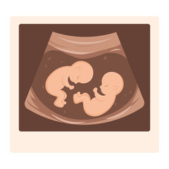Vector cartoon image of ultrasound scan with baby. Pregnancy management concept. Element for your design