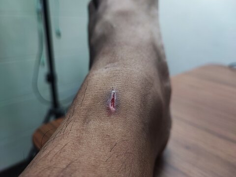 Small wound on the ankle, wound caused by a sharp object, dark spots around the wound.