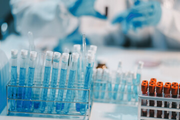 Research, experiment and medical trial being done by a scientist in a lab, science facility or...