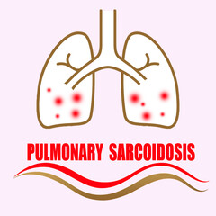 This medical illustration of pulmonary sarcoidosis features a sick lung design, showing the internal damage and inflammation caused by the disease 