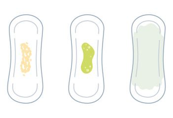 女性の健康　おりものの色の種類　ナプキン