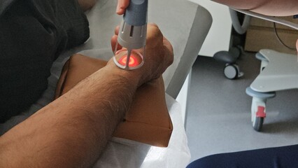 Laser treatment session for skin condition on patient arm in a medical facility concept
