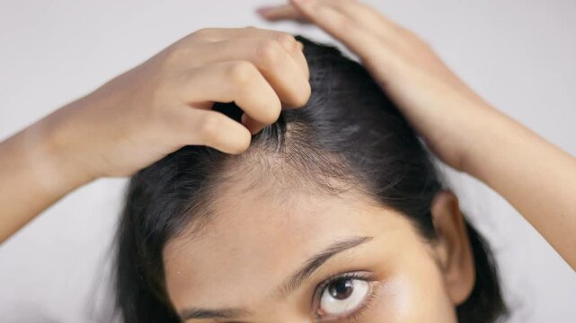 In white background a young woman suffering from hairloss showing her scalp