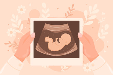 Vector cartoon image of pregnancy confirmation in girl's hands. Desired pregnancy. Ultrasound image. Concept of motherhood and children. Element for your design