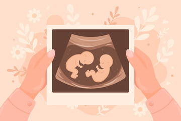 Vector cartoon image of pregnancy confirmation in girl's hands. Desired pregnancy. Ultrasound image. Concept of motherhood and children. Element for your design