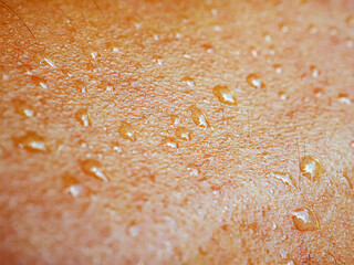 Skin, macro of water drops and texture or body of a person, armhair human and sweat with droplets