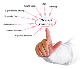 factors Influencing Risk of Breast Cancer