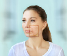Signs of skin aging,signs of premature aging,
Wrinkles and fine lines