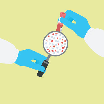 Acute lymphoblastic leukaemia,Children,Teenagers and young adults,myeloid, A flat vector illustration depicting Acute Lymphoblastic Leukaemia, highlighting abnormal white blood cells in blood flow,