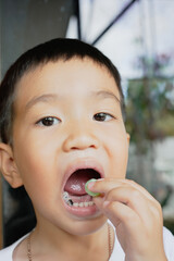 This boy lost his teeth from eating sweets and nibbles, which is likely due to natural loss. His smile reveals gaps where teeth used to be, giving him an attractive, young, and cheerful appearance.