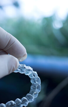 Dental Aligners: A Comprehensive Guide to Clear Teeth Straightening