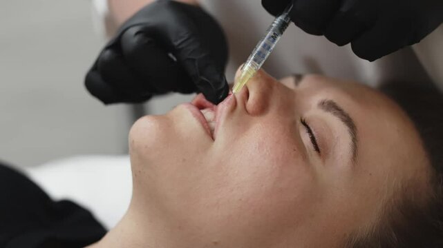 Close-up of cosmetologist's hands with syringe making careful beauty injections to young woman's lips. Concept of cosmetology and injection procedures.