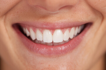 A woman with a big smile on her face, showing off her teeth. Concept of happiness and confidence