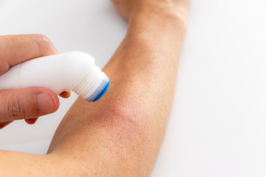 虫に刺された腕に薬を塗る