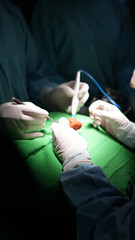 Medical Team Performing Surgery in Operating Room Close Up View