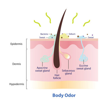 The mechanism of body odor illustration. The body odor is caused by a mix of bacteria and sweat on skin surface. Cross section of hair follicle, eccrine and apocrine sweat gland, produce body odor.