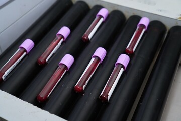 collection of blood sample tubes in a mixer in the laboratory