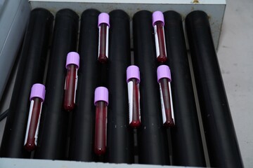 collection of blood sample tubes in a mixer in the laboratory