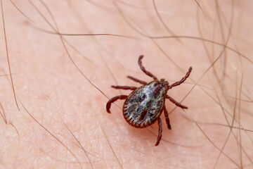 a tick crawls mite on a person's arm, close-up, macro