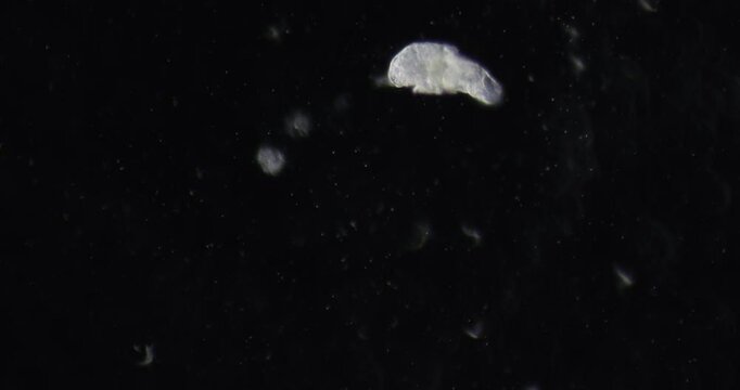 Microscopic rotifer (Rotifera) moves across field of view under 200x magnification in dark field method, showing ciliary activity, digestive system, and organism behavior