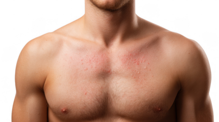 Close up of a male chest exhibiting symptoms of a skin allergy, such as redness and small bumps, against a transparent background, emphasizing the visibility of the skin condition