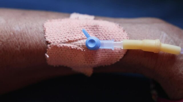 patient hand with IV cannula in clinical environment at indoor