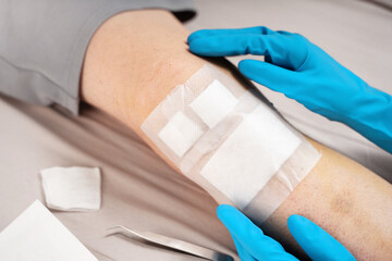 Medical professional hands in gloves change bandage on a patient bruised knee using sterile...