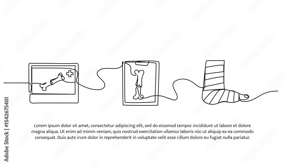 Aufkleber vector illustration of x-ray results of a broken leg. modern flat in continuous line style.