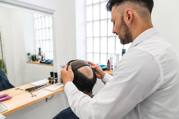 Obraz premium Hairdresser placing hair system on balding man in hair clinic, offering solution for alopecia and hair loss