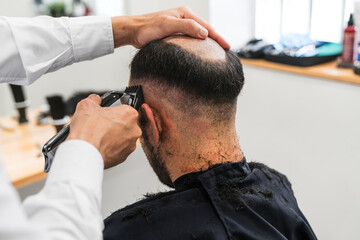 Hair transplant clinic doctor preparing patient for hair implant surgery, shaving head with...