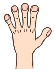 太鼓ばち指（ばち指）、慢性疾患に合併する指先の変形