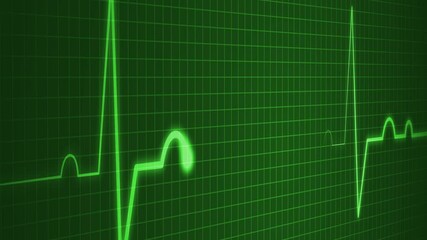 Electrocardiogram Pulse Line Animation for Medical Technology, Electrocardiogram Line on Grid Background