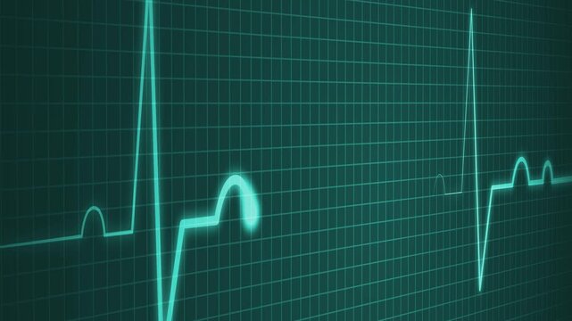 Electrocardiogram Pulse Line Animation for Medical Technology, Electrocardiogram Line on Grid Background