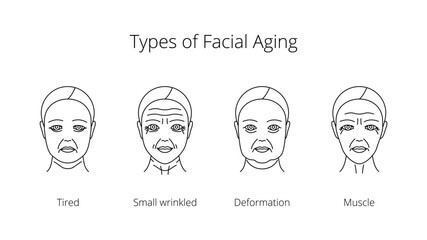 Set of icons types of facial aging: tired, small wrinkled, deformation, muscle. Women aging process illustration line style, editable stroke 