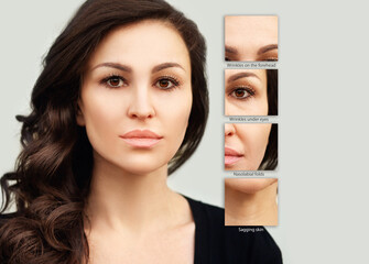 Signs of skin aging,signs of premature aging,
Wrinkles and fine lines,Age spots,Sagging...