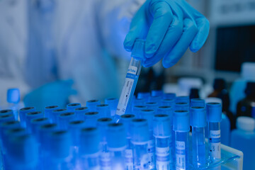 a female chemist is testing various liquid compounds in a lab, a scientist is doing research on the...