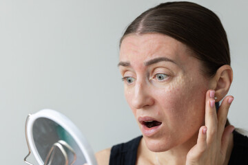 Woman shocked how looks her face after biorevitalization. 