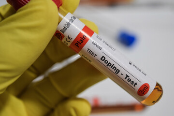 Doping - Test with blood sample. Top view isolated on office desk. Healthcare or Medical concept