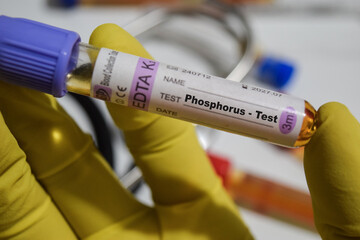 Phosphorus - Test with blood sample. Top view isolated on office desk. Healthcare or Medical concept
