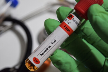 Parvovirus - Test with blood sample. Top view isolated on office desk. Healthcare or Medical concept