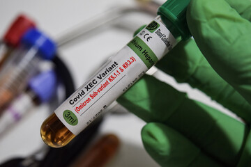 Covid XEC Variant - Test - Omicron SUb-variant KS.1.1 and KP 3.3 with blood sample. Top view...