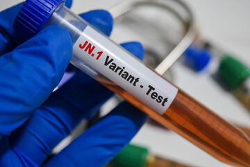 JN.1 Variant - Test with blood sample. Top view isolated on office desk. Healthcare or Medical...