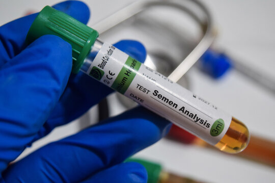 Semen analysis - Test with blood sample. Top view isolated on office desk. Healthcare or Medical concept