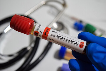BRCA-1 and BRCA-2 - Test with blood sample. Top view isolated on office desk. Healthcare or Medical...