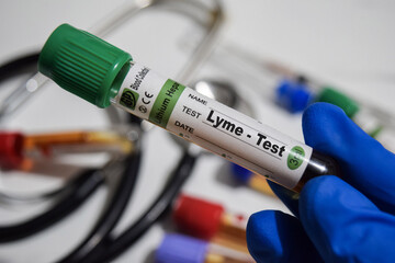 Lyme - Test with blood sample. Top view isolated on office desk. Healthcare or Medical concept