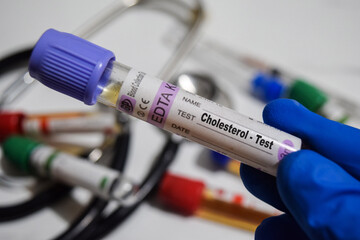Cholesterol - Test with blood sample. Top view isolated on office desk. Healthcare or Medical...